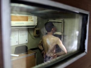 Potret Warga Lakukan Deteksi Dini TBC di Medan