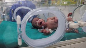 Melihat Perawatan Bayi Prematur yang Dievakuasi dari Gaza