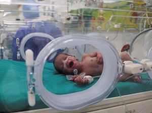 Melihat Perawatan Bayi Prematur yang Dievakuasi dari Gaza