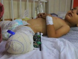 Pilu Anak-anak Gaza Terluka Akibat Serangan Israel-Jadi Yatim Piatu