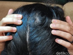 Dikeroyok Saat Debat Pemilihan Ketua Dema, Mahasiswa Semarang Ngadu ke Polisi