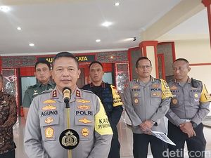 Kapolda Sumut Pastikan 5 Mayat di Unpri Cadaver Kapolda Sumut Pastikan 5 Mayat di Unpri Cadaver