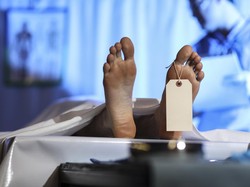 Temuan Mayat di Medan Ternyata Kadaver, Begini Cara Kelola dan Mendapatkannya