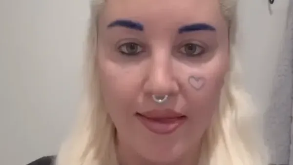 Foto Baru Amanda Bynes Setelah Operasi Lipatan Mata, Hampir Tak Dikenali