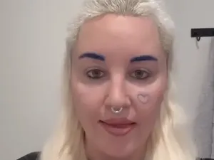 Foto Baru Amanda Bynes Setelah Operasi Lipatan Mata, Hampir Tak Dikenali Foto Baru Amanda Bynes Setelah Operasi Lipatan Mata, Hampir Tak Dikenali