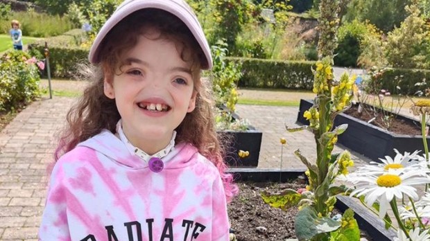 Tessa Evans/Foto: Instagram.com/tessabornextraordinary Kisah inspirasi Tessa Evans yang dijuluki Voldemort karena lahir tanpa hidung