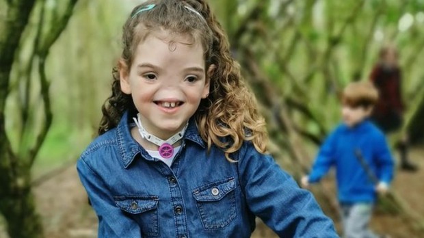 Tessa Evans/Foto: Instagram.com/tessabornextraordinary Kisah inspirasi Tessa Evans yang dijuluki Voldemort karena lahir tanpa hidung