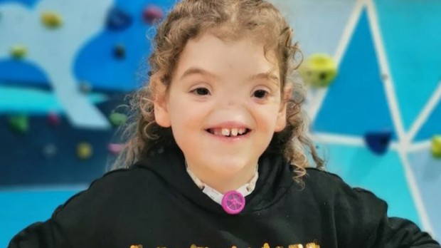 Tessa Evans/Foto: Instagram.com/tessabornextraordinary Kisah inspirasi Tessa Evans yang dijuluki Voldemort karena lahir tanpa hidung