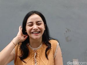 Mawar AFI Puas dengan Operasi Plastik, Habiskan Hingga Rp 70 Juta