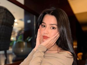 Cerita Susan Sameh Dibully Saat Kecil Karena Alergi Panas Cerita Susan Sameh Dibully Saat Kecil Karena Alergi Panas