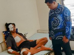 Pemuda Situbondo Babak Belur Ngaku Dihajar Diduga 6 Oknum Polisi