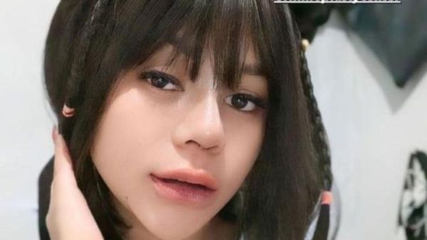 7 Foto Terbaru Cimoy Montok Setelah Oplas Hidung, Wajahnya Kini Manglingi