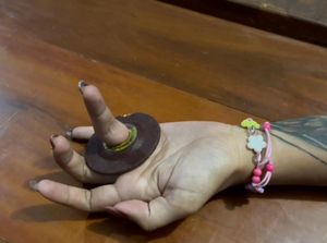 Ada-ada Saja, Jari Perempuan Trenggalek Ini Tersangkut Lubang Mata Gerinda