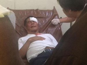 Kondisi Pj Gubernur Papua Usai Kena Lempar Batu Massa Antar Jenazah Enembe Kondisi Pj Gubernur Papua Usai Kena Lempar Batu Massa Antar Jenazah Enembe