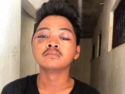 Jukir di Makassar Babak Belur Diamuk Warga Usai Kepergok Curi Motor Ojol