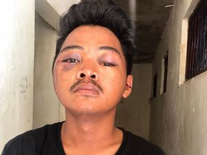 Jukir di Makassar Babak Belur Diamuk Warga Usai Kepergok Curi Motor Ojol Jukir di Makassar Babak Belur Diamuk Warga Usai Kepergok Curi Motor Ojol
