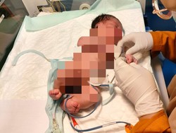 Nelangsa Bayi Baru Satu Jam Dilahirkan Dibuang di Persawahan Blitar