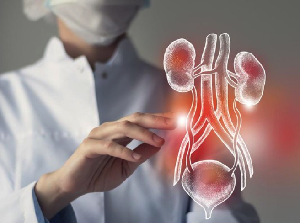 Mengenal ECIRS, Tatalaksana bagi Kasus Batu Saluran Kemih Kompleks