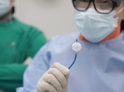 Mengobati Detak Jantung Tak Beraturan dengan Terapi Es, Bisakah?