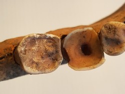 Orang Viking di Abad ke-10 Sudah Lakukan Perawatan Gigi yang Rumit, Begini Buktinya