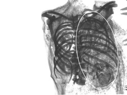 Pertama, Ahli Temukan Mumi Remaja Mesir dengan Janin Kembar