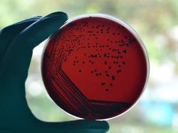 Puluhan Spesies Bakteri Baru Ditemukan di Tubuh Manusia