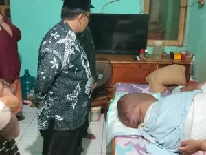 Kata Kemenkes soal Pria Tangerang Kena Limfedema-Obesitas, BB 230 Kg Kata Kemenkes soal Pria Tangerang Kena Limfedema-Obesitas, BB 230 Kg
