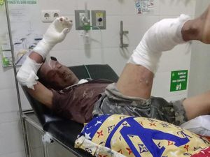 Garasi dan Mobil di Mojokerto Ludes Terbakar, Pemilik Luka-luka