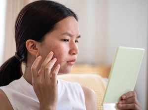 10 Skincare Alami yang Bantu Menghilangkan Bekas Jerawat 10 Skincare Alami yang Bantu Menghilangkan Bekas Jerawat