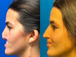 Influencer Ini Kehilangan Bibir usai Diserang Anjing, Begini Kisahnya