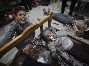 Kisah Pilu Dokter Rawat Anak-anak yang Matanya Hancur Imbas Ledakan di Gaza