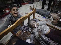 Kisah Pilu Dokter Rawat Anak-anak yang Matanya Hancur Imbas Ledakan di Gaza