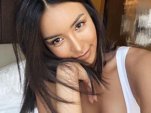 Potret Model yang Kisahnya Tragis, Tangan Diamputasi karena Alasan Misterius Potret Model yang Kisahnya Tragis, Tangan Diamputasi karena Alasan Misterius