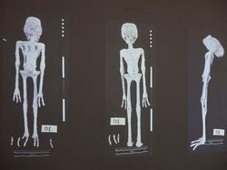 Kontroversi Mumi Alien di Peru, Sidik Jarinya Disebut Tak Cocok dengan Manusia