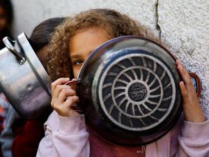 Cerita Dokter Kanada Rawat Anak-anak Gaza yang Matanya Hancur