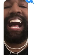 Penampakan Gigi Titanium Rp 13 Miliar Kanye West