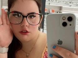 Kisah Model yang Tidak Pernah Tersenyum,  Ternyata Mengidap Kondisi Ini