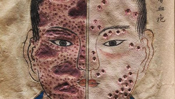 Benda Langka Koleksi Museum, Ada yang Menyeramkan