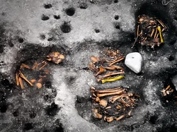 Tulang Belulang Ini Jadi Bukti Sifilis Muncul di Brasil 2.000 Tahun Lalu