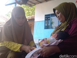 Viral Bayi di Sampang Lahir dengan 24 Jari, Begini Penjelasan Medisnya Menurut Dokter