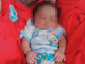 Bayi Ini Lahir dengan 24 Jari di Tangan dan Kaki, Netizen Kagum Bayi Ini Lahir dengan 24 Jari di Tangan dan Kaki, Netizen Kagum