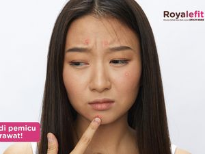 Usus Kotor Jadi Pemicu Munculnya Jerawat, Ini Penyebab dan Solusinya