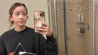 Foto Wanita Digigit Anjing Hingga Hidung Sobek, Ini Transformasi 10 Kali Oplas