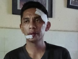 ASN di Kendari Diduga Dianiaya Sekretaris BPSDM Sultra, Polisi Selidiki