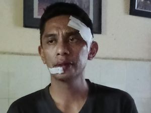 ASN di Kendari Diduga Dianiaya Sekretaris BPSDM Sultra, Polisi Selidiki ASN di Kendari Diduga Dianiaya Sekretaris BPSDM Sultra, Polisi Selidiki