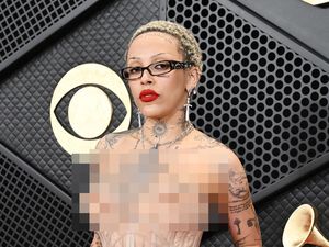 Doja Cat Pamer Implan Payudara Tidak Simetris, Korban Gagal Operasi Plastik? Doja Cat Pamer Implan Payudara Tidak Simetris, Korban Gagal Operasi Plastik?