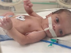 Kisah Pilu Anak-anak Gaza Jadi Yatim Piatu saat Perang Tak Sudah-sudah