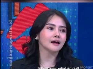 Wajah Baru Mawar AFI Usai Oplas Kembali Disorot, Hidungnya Bikin Salfok