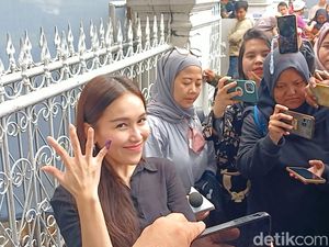 Ayu Ting Ting Masih Berasa Mimpi Usai Dilamar Lettu Muhammad Fardhana