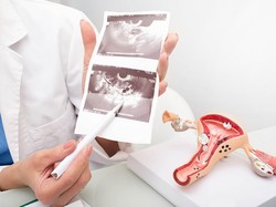 Penyebab Penebalan Dinding Rahim, Faktor Risiko, Gejala, dan Pengobatannya